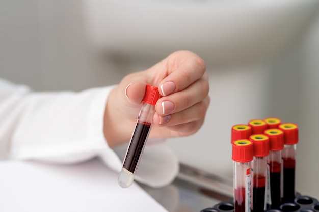 Что означает анализ крови ЛПОНП?