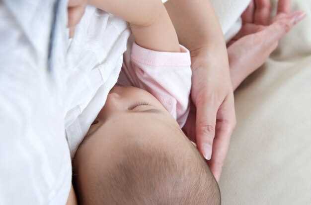 Симптомы пупочной грыжи у новорожденных