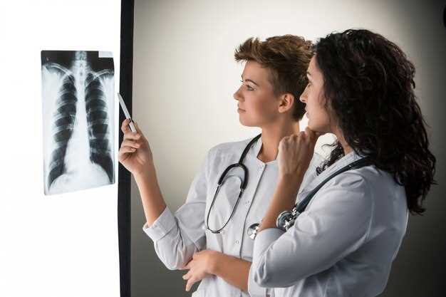 Методы диагностики туберкулеза легких