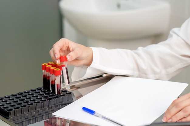 Как анализировать функцию почек через анализ крови