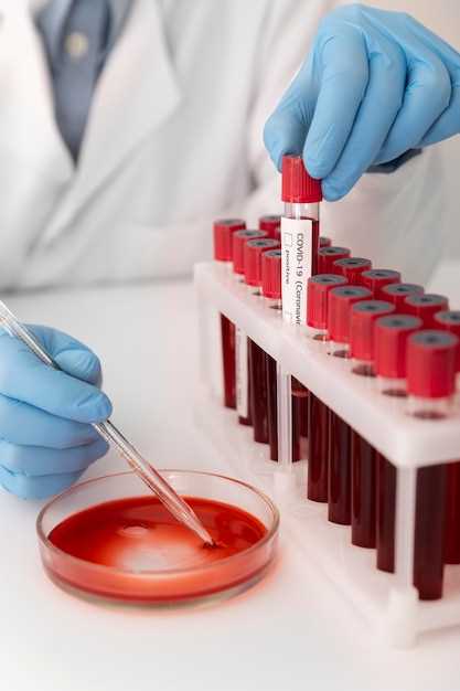 Как определить лейкоз по анализу крови?
