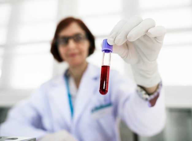 Значение общего терапевтического анализа крови
