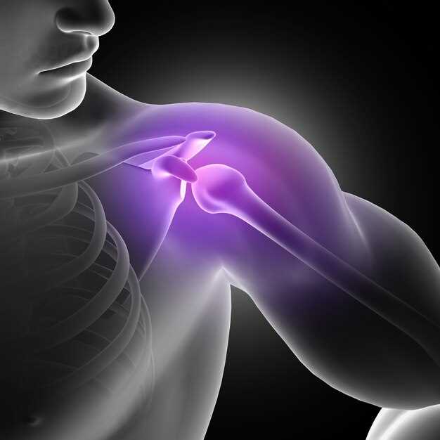 Как оказать первую помощь при растяжении связок плечевого сустава