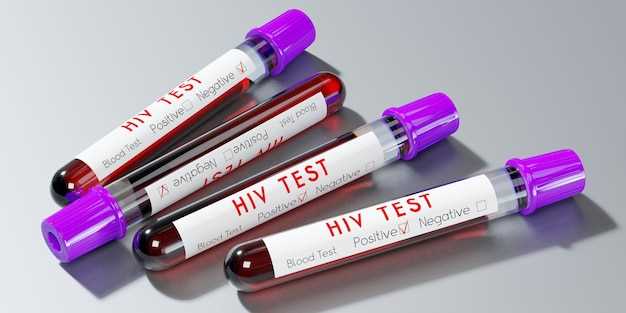 Сроки и процесс проведения теста на ВИЧ-инфекцию