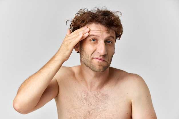 Проблемы сухой кожи головы у мужчин