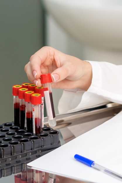 Как измеряют мочевую кислоту в крови?